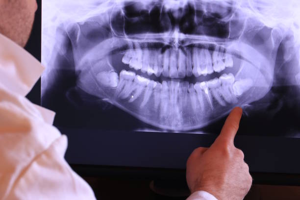 Best Emergency Dentist for Knocked-Out Tooth in Mount Vernon, IL